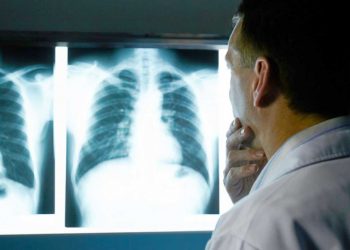 Médicos especialistas de Santiago advierten alto riesgo del uso de vape por jóvenes