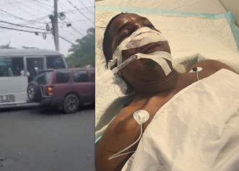 Conductor de yipeta atropellado por chofer de guagua se encuentra en estado delicado