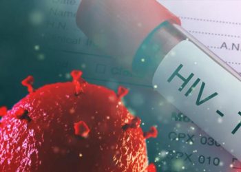 Cerca de 79,000 en el país viven con VIH