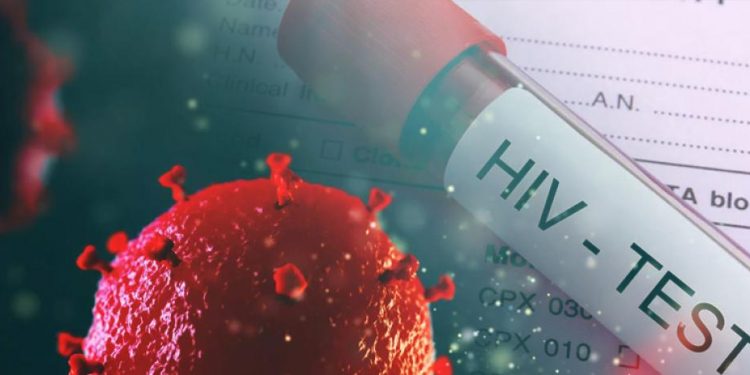 Cerca de 79,000 en el país viven con VIH