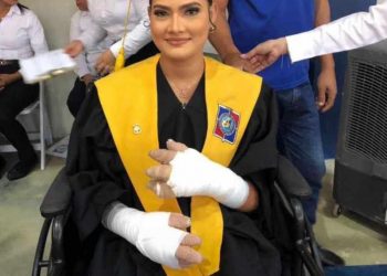 Ysell Abreu se graduó tras sacrificar sus manos para intentar salvar a su hijo en carnaval de Salcedo