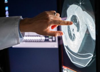 El cáncer sigue afincado entre los mayores desafíos de sistemas de salud