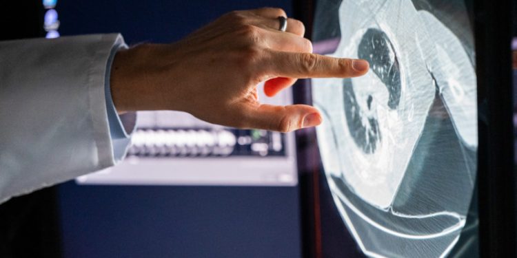 El cáncer sigue afincado entre los mayores desafíos de sistemas de salud