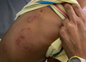 Inaipi despide personal por agresión a niño en Caipi de Santiago