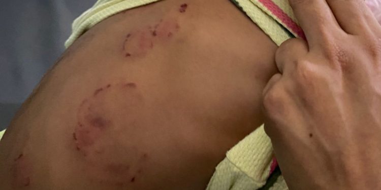 Inaipi despide personal por agresión a niño en Caipi de Santiago