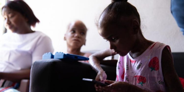 Presidencia suplirá medicamentos a niñas con “Piel de Cristal”