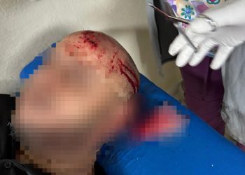 Migración denuncia que haitianos indocumentados agreden agentes en Puerto Plata