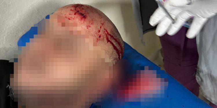 Migración denuncia que haitianos indocumentados agreden agentes en Puerto Plata