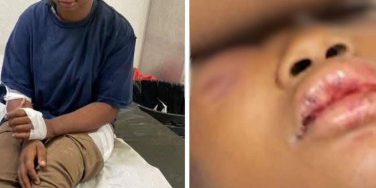 Policía rescata a joven raptada y golpeada por su expareja en Las Matas de Santa Cruz