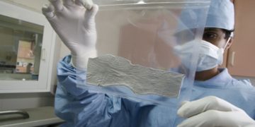 República Dominicana tendrá banco de piel y tejidos humanos