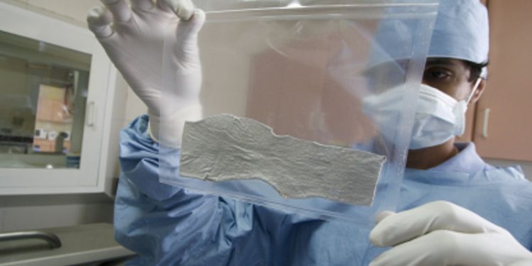 República Dominicana tendrá banco de piel y tejidos humanos