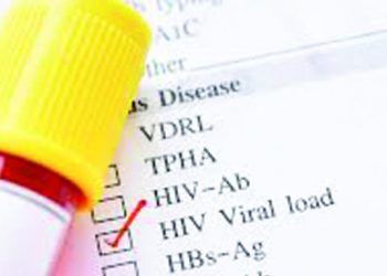 Registran más de 55,000 pacientes con carga viral de VIH durante un año