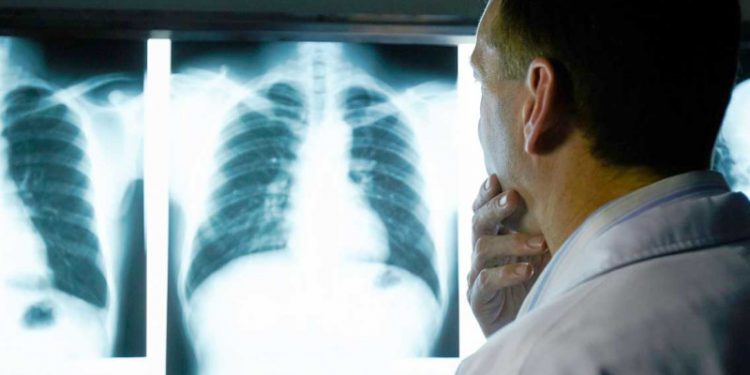 Médicos especialistas de Santiago advierten alto riesgo del uso de vape por jóvenes