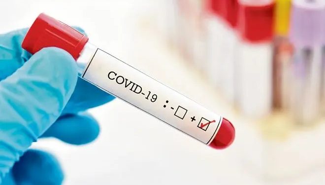 OMS pide a los países que mantengan la vigilancia del virus de la covid-19