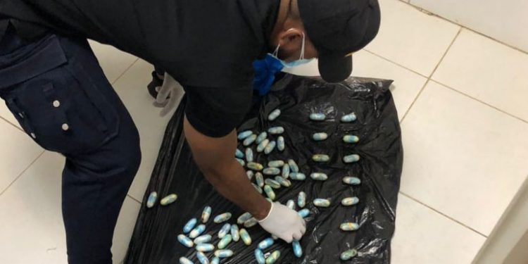 Atrapan extranjero en AIPC con 76 cápsulas de drogas en el estómago
