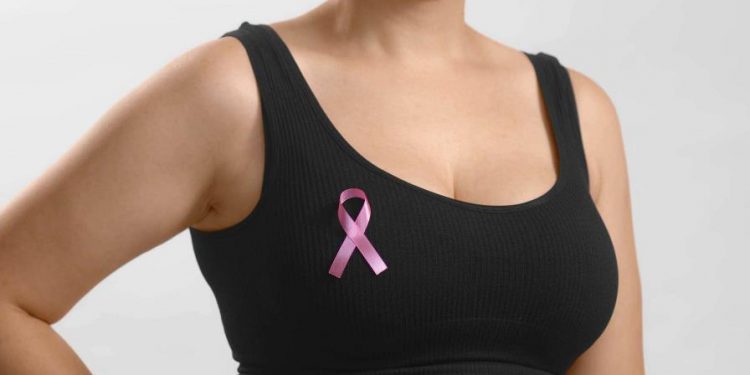 El 57 % de los casos de cáncer de mama en el país se diagnostican en etapa avanzada