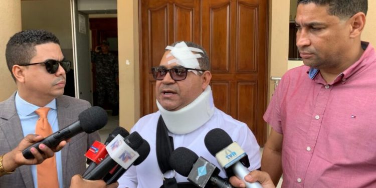 Regidor de Verón-Punta Cana denuncia ataque por parte de empleados de Coco Bongo