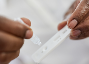 Costo de pruebas limita cifras de virus respiratorios en Santiago