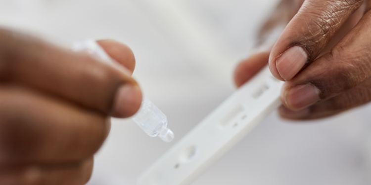 Costo de pruebas limita cifras de virus respiratorios en Santiago