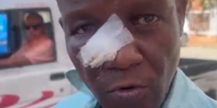 Profesor agredido por estudiantes afirma que tiene la nariz fracturada