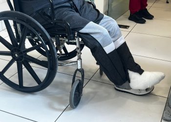 Unidad de Pie Diabético del Cabral y Báez reduce amputaciones en la región Norte