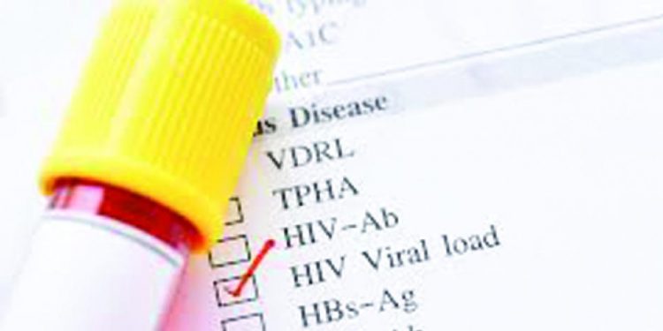 Registran más de 55,000 pacientes con carga viral de VIH durante un año
